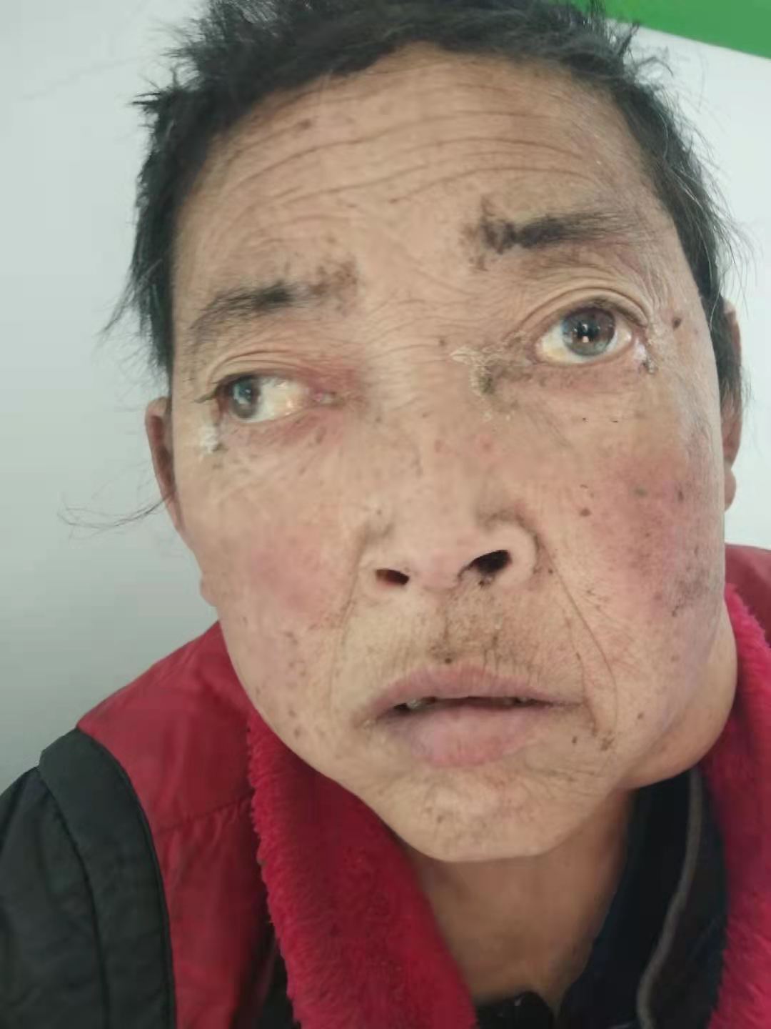 走失者照片 乌兰察布寻亲：五旬女子被救助，穿红...