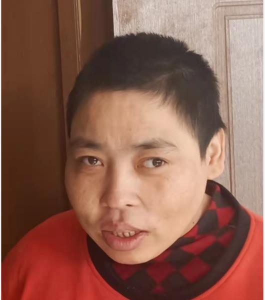 走失者照片 衡水寻亲：青年女子被救助多年，高1...