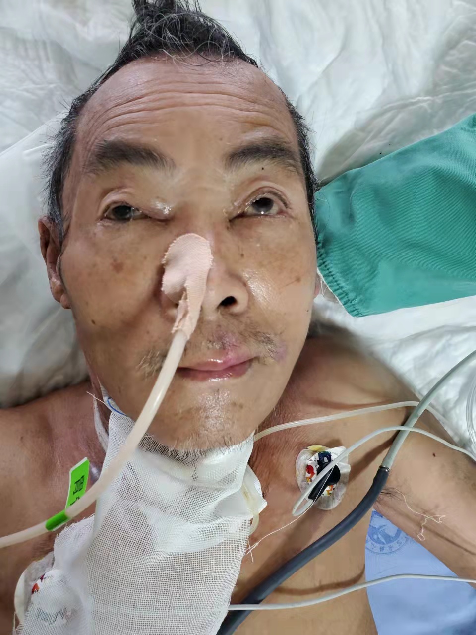 走失者照片 五旬男子在自贡遭遇车祸被送医，现重...
