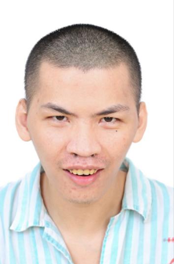 走失者照片 佛山寻亲：青年男子被救助数年，疑似...