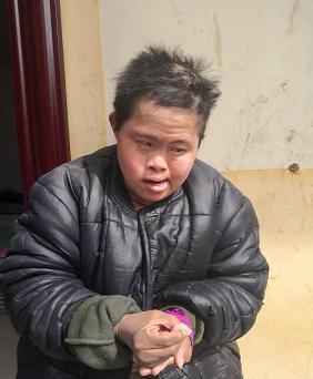 走失者照片 漯河寻亲：青年女子被救助多年，高1...