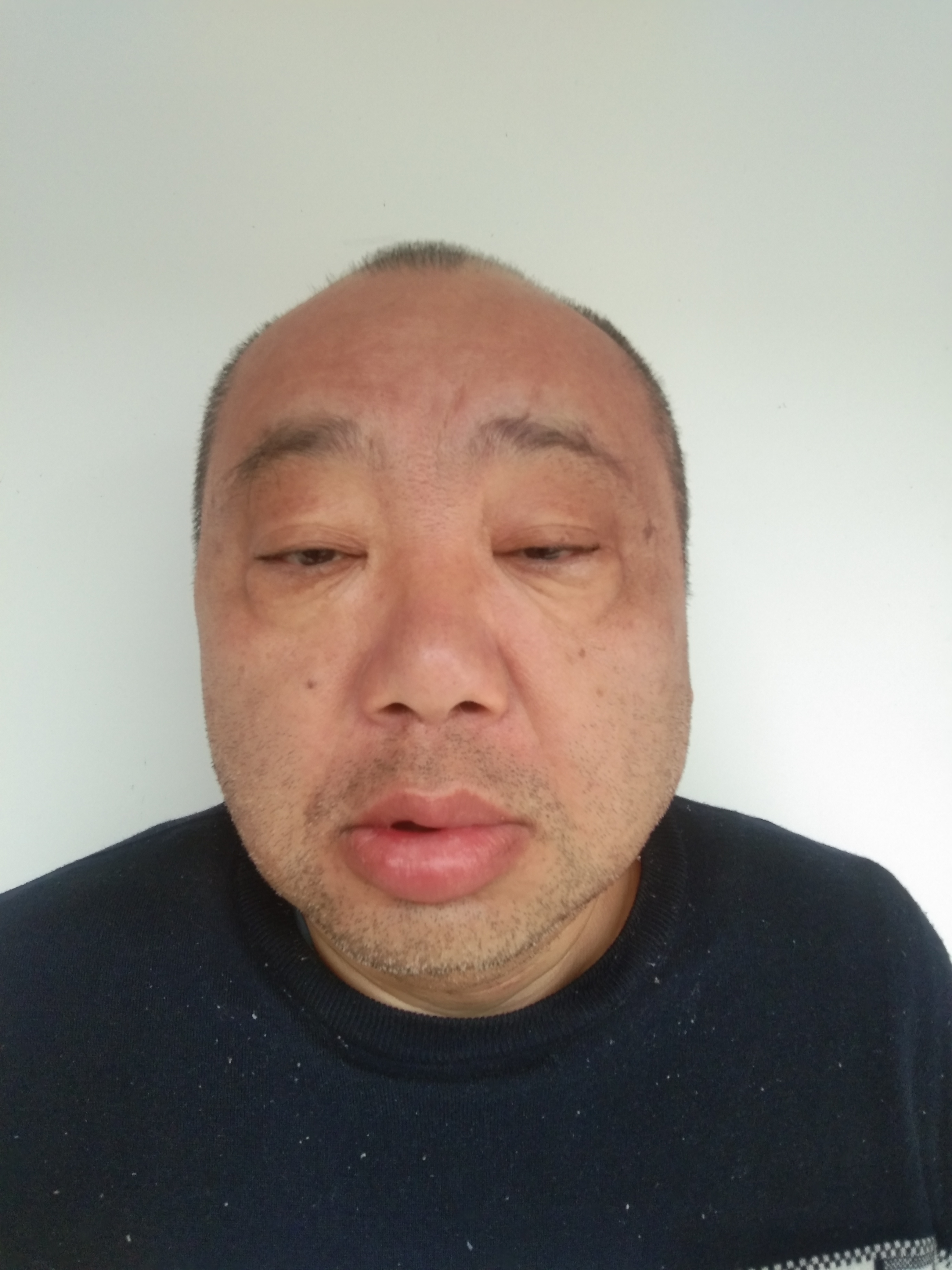 走失者照片 郴州寻亲：五旬男子被救助，江浙口音...