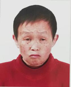 走失者照片 保定寻亲：五旬女子被救助，高1米5...