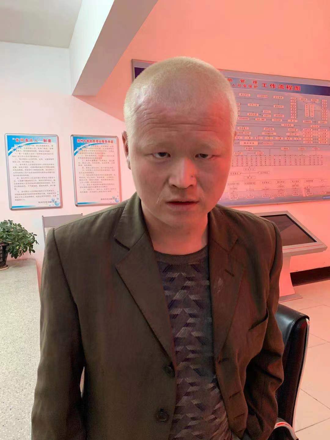 走失者照片 荆州寻亲：中年男子被救助多年，白发...