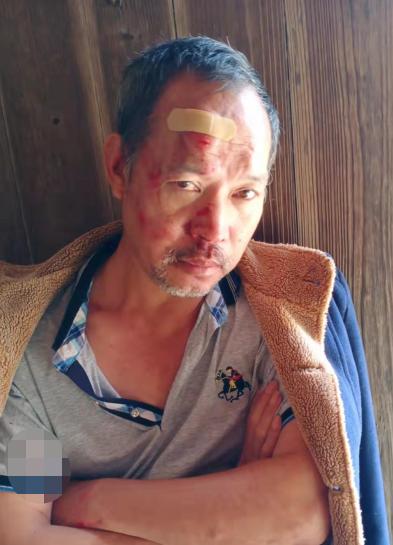 走失者照片 泉州急寻！石狮五旬男子走失，患车祸...