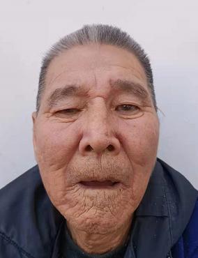 走失者照片 邵阳寻亲：六旬老人被救助，疑患老年...