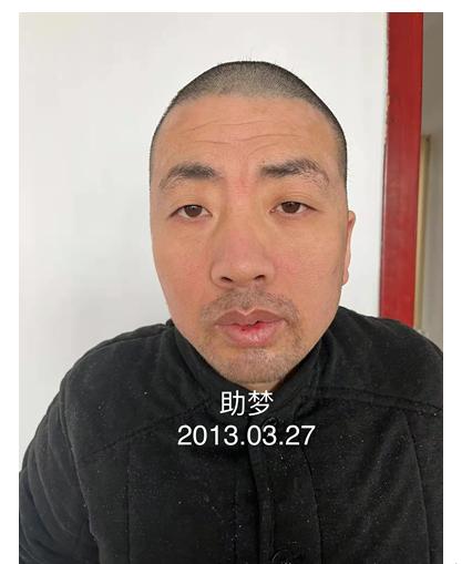 走失者照片 临沂寻亲：中年男子被救助，疑患精神...