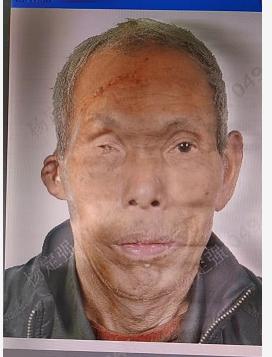 走失者照片 黔东南州急寻：八旬老人失联，高1米...