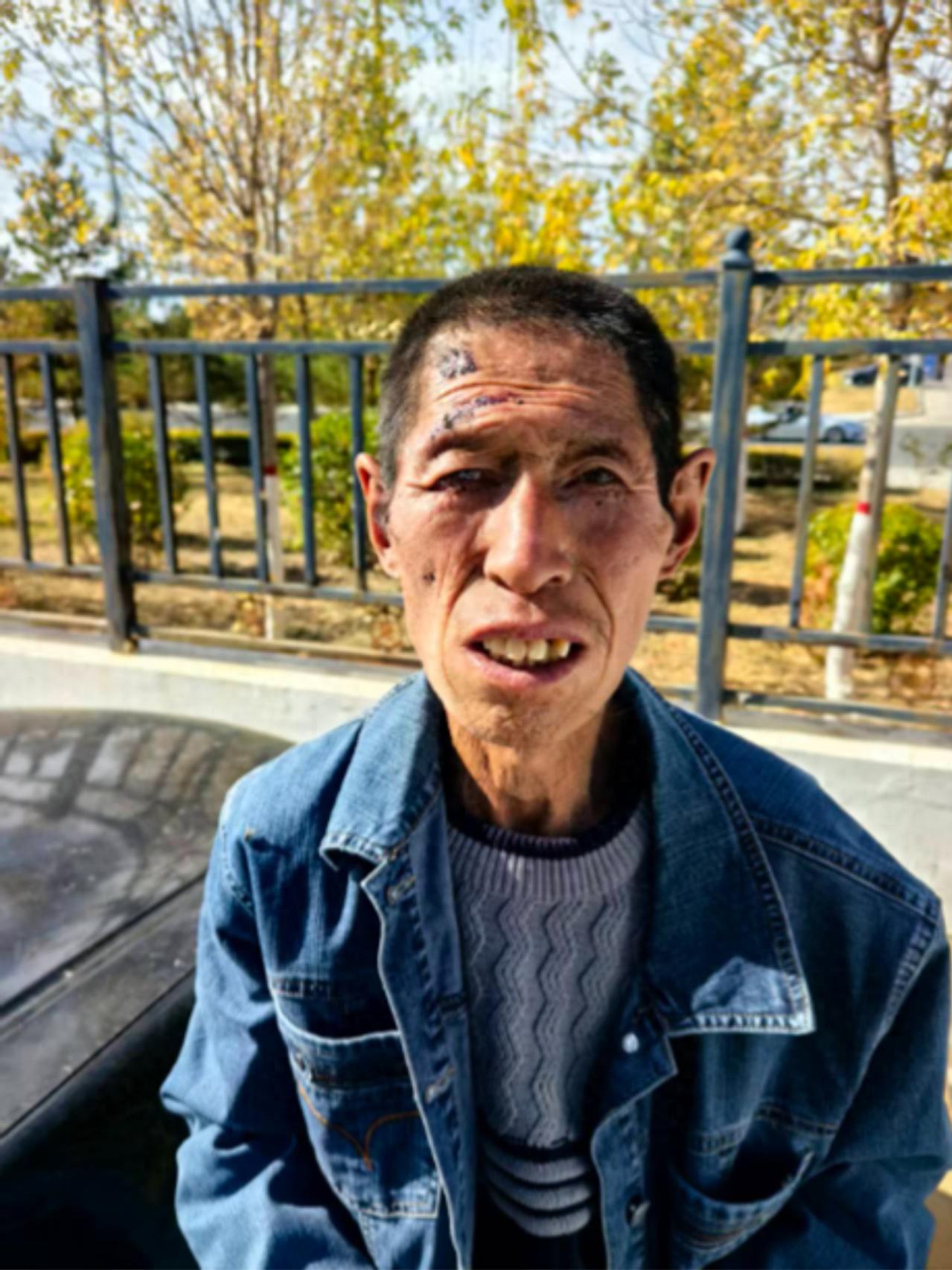 走失者照片 锡林郭勒锡林浩特寻亲：五旬男子被救...