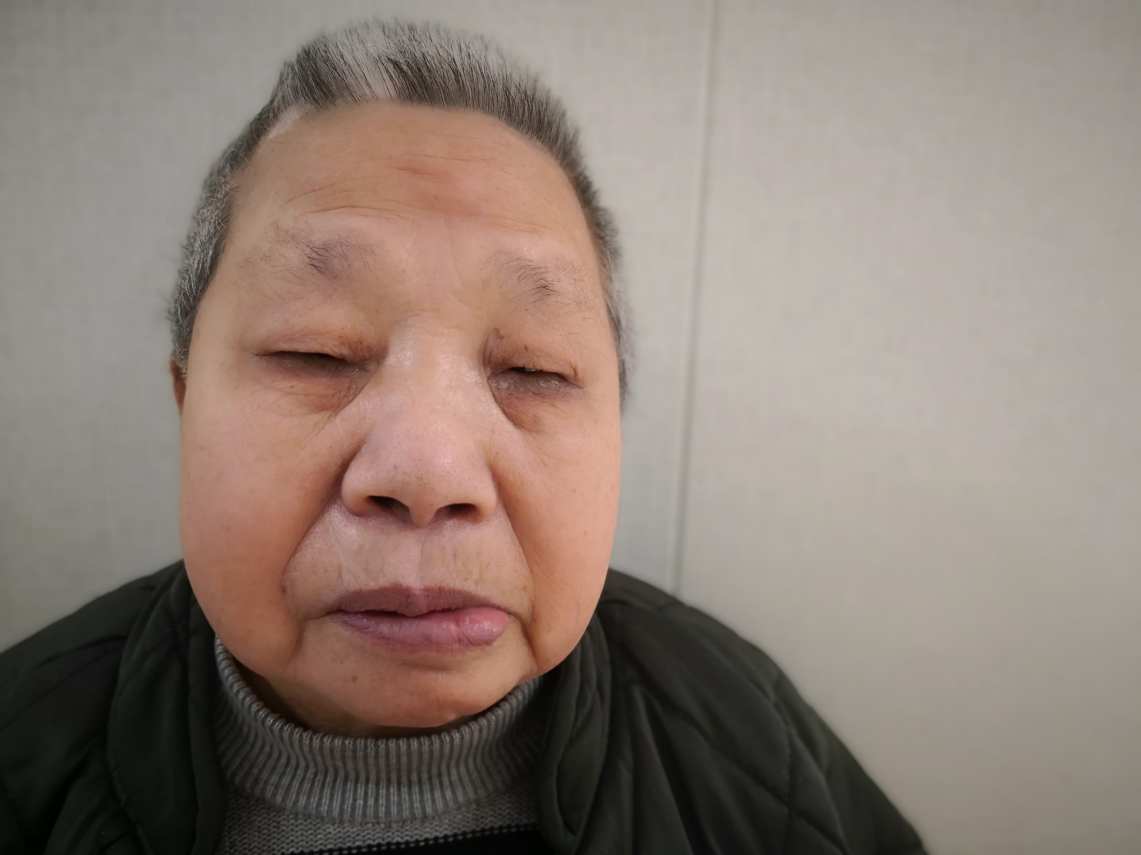 走失者照片 寻亲：八旬老太在金华被救助多年，自...