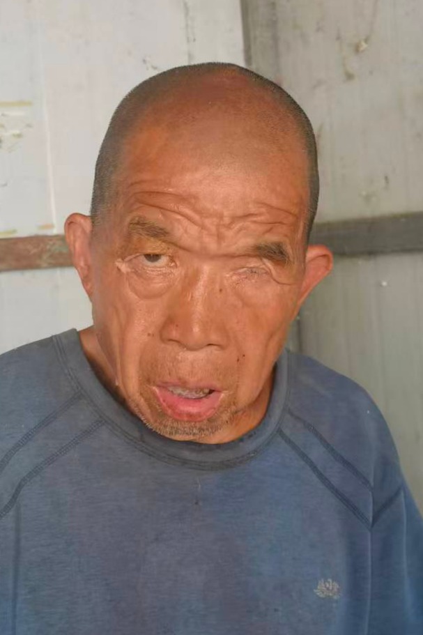 走失者照片 全国救助站