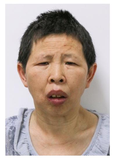 走失者照片 帮她回家：青年女子在贵阳被救助，言...