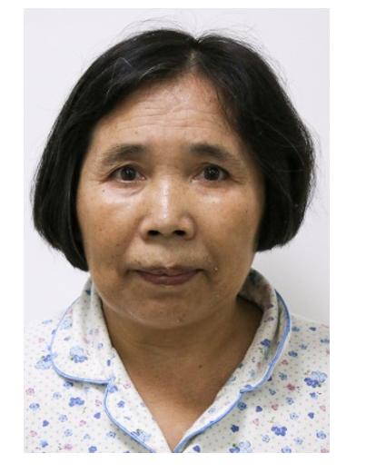 走失者照片 贵阳寻亲：五旬女子被救助多年，言行...