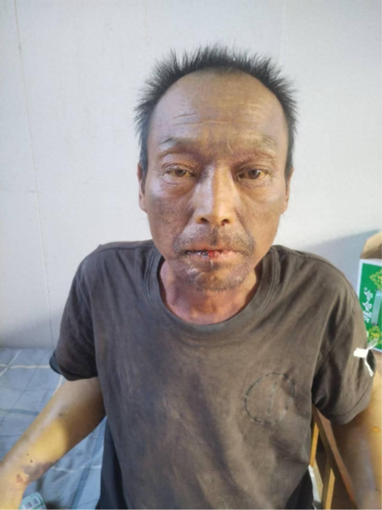 走失者照片 保定市定州市寻亲：五旬男子因病医治...