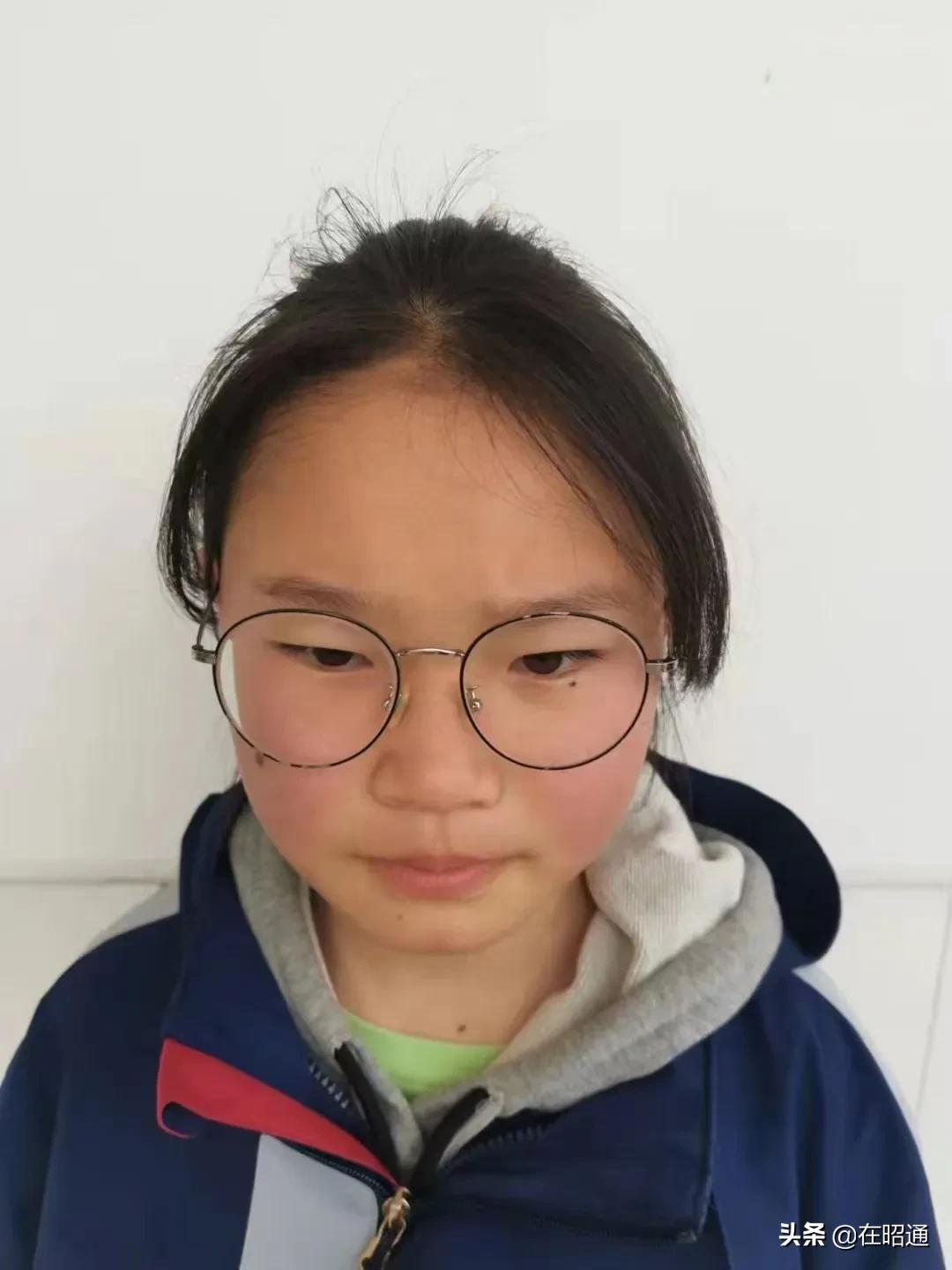 走失者照片 孩子你在哪儿？昭通14岁女孩失联，...