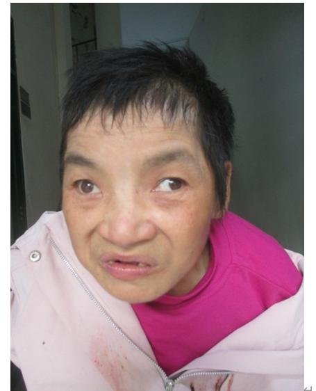 走失者照片 泸州寻亲：青年女子被救助，高1米5...