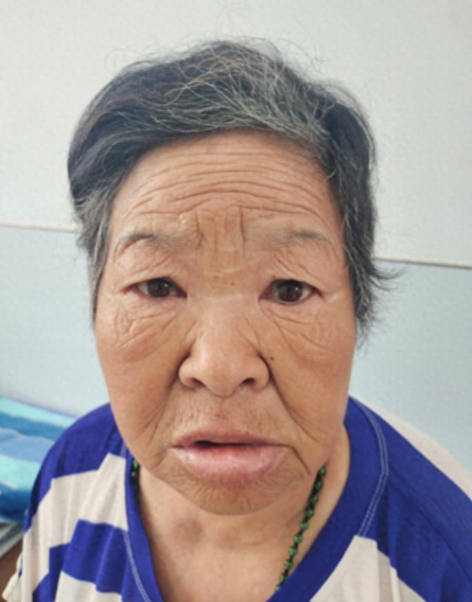 走失者照片 商丘市寻亲：六旬老太被救助，自述叫...