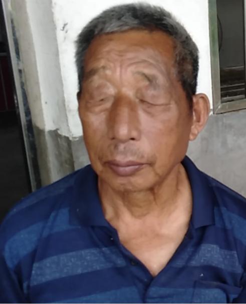 走失者照片 长沙急寻！八旬老人走失，穿黑色棉衣...