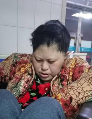 走失者照片 临沂寻亲：青年女子被救助，疑患唐氏...