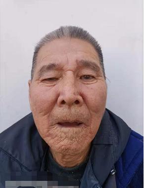走失者照片 邵阳寻亲：七旬老人被救助，穿黑色上...