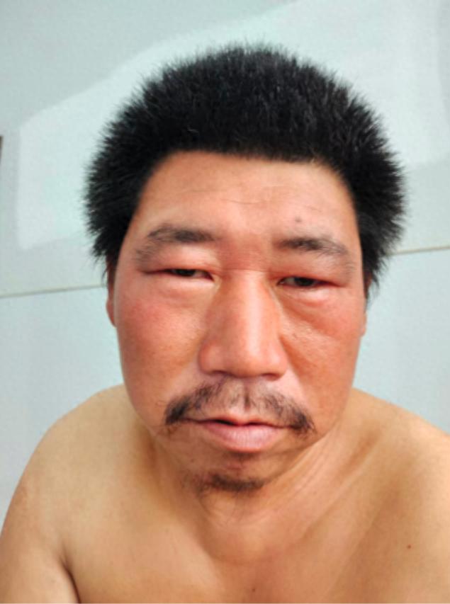 走失者照片 商丘市寻亲：青年男子被救助，高1米...