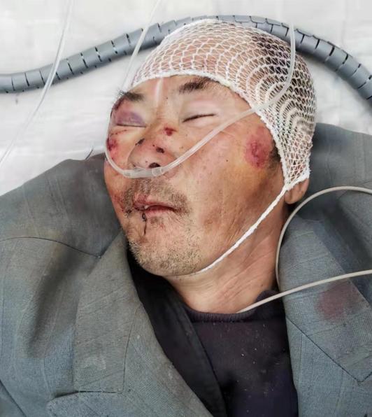 走失者照片 患者寻亲：邢台六旬老人因车祸被送医...