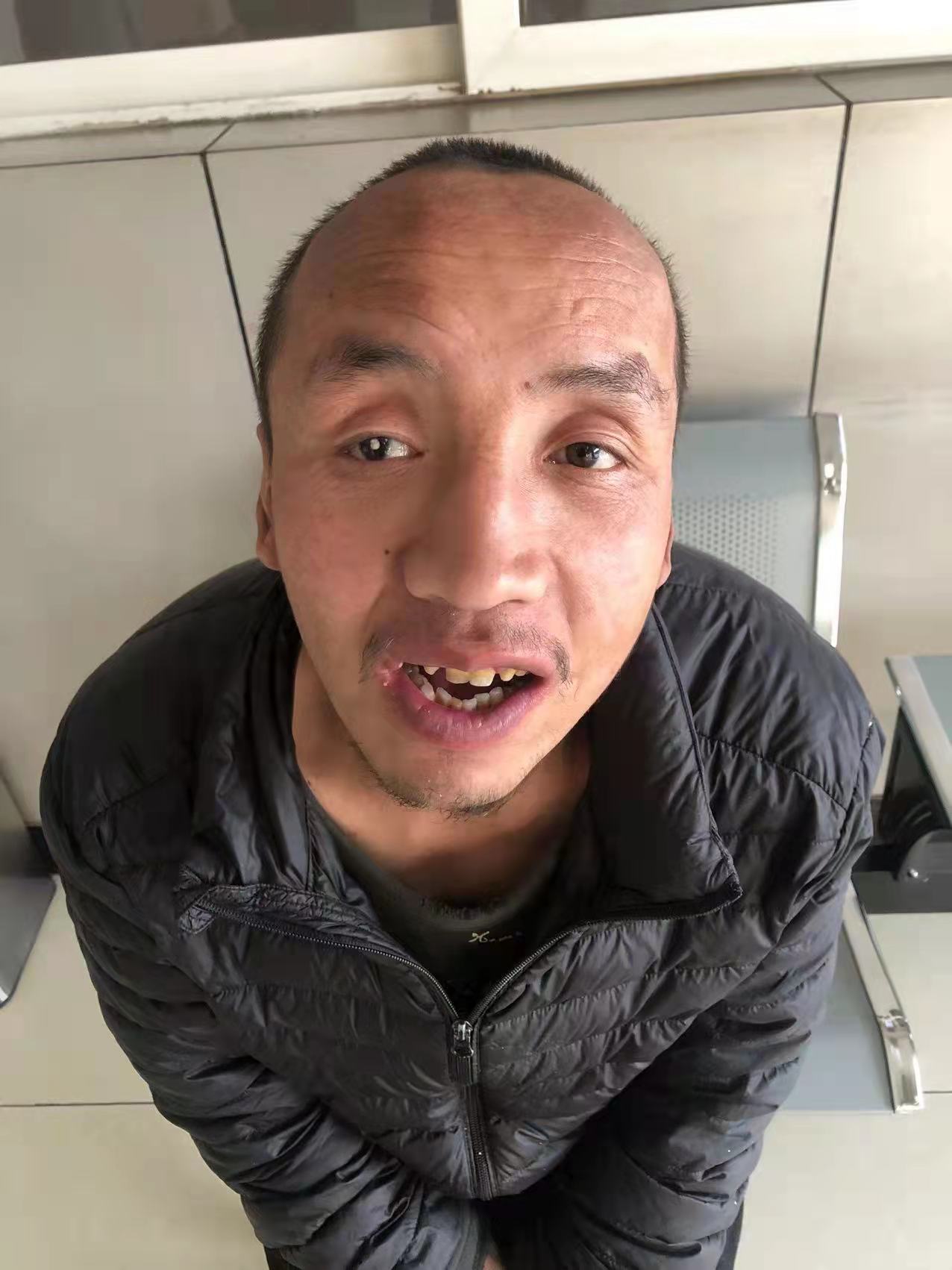 走失者照片 焦作寻亲：中年男子被救助，自述叫黄...