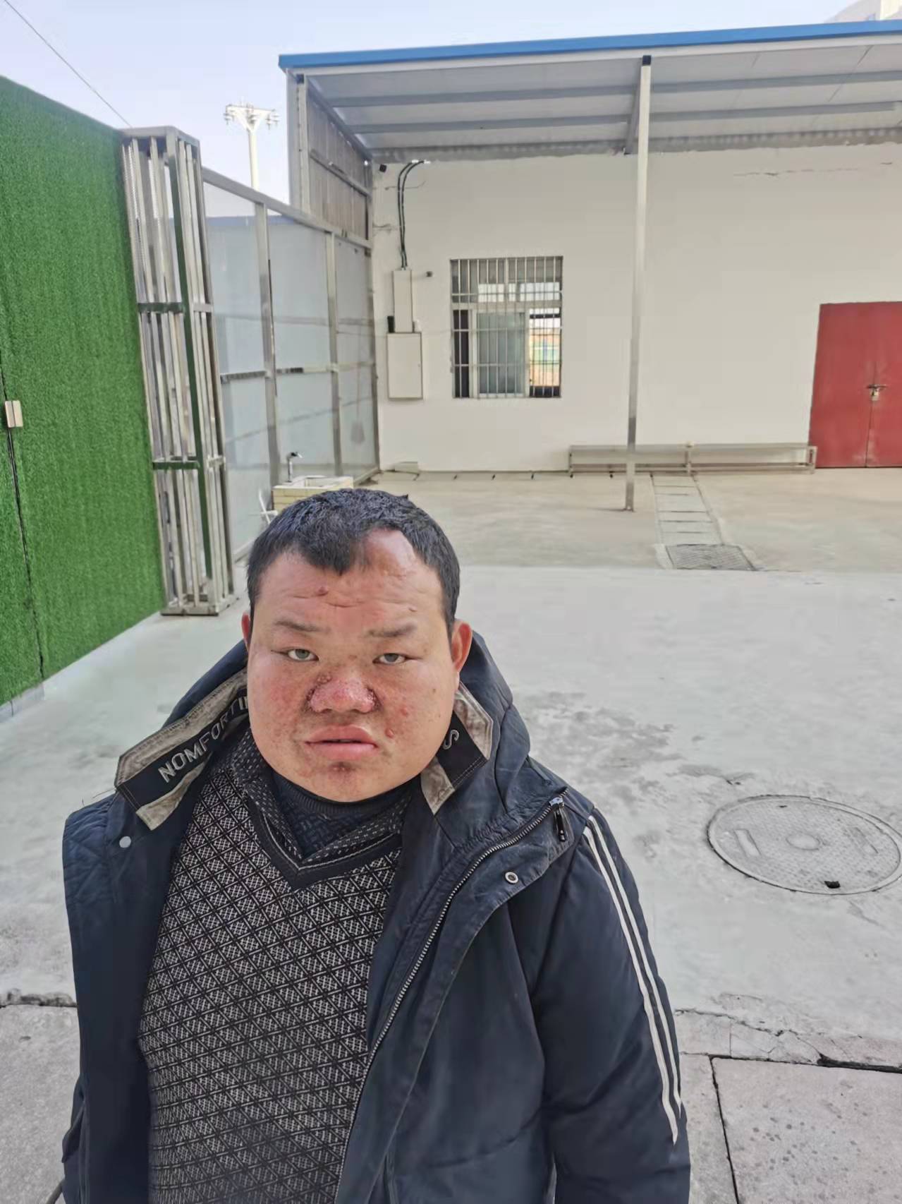 走失者照片 随州寻亲：青年男子被救助，穿黑色衣...