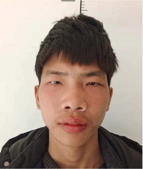 走失者照片 阜阳寻亲：18岁少年被救助，自述叫...
