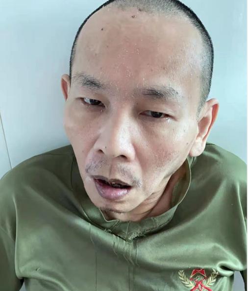 走失者照片 汕头寻亲：中年男子被送医，经诊断患...