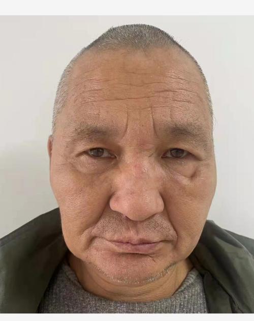 走失者照片 威海寻亲：荣成六旬老人被救助，穿黑...