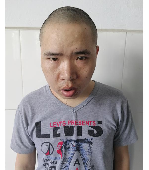走失者照片 寻亲：中年男子在汕头被救助，自述是...