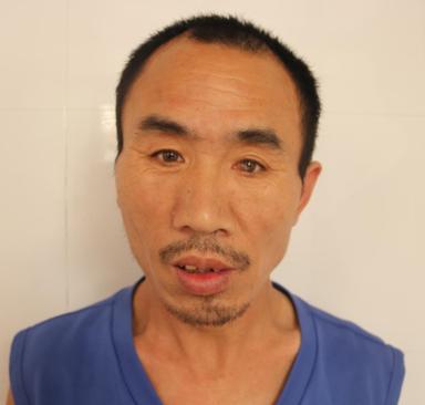 走失者照片 衢州寻亲：五旬男子被救助，口齿不清...