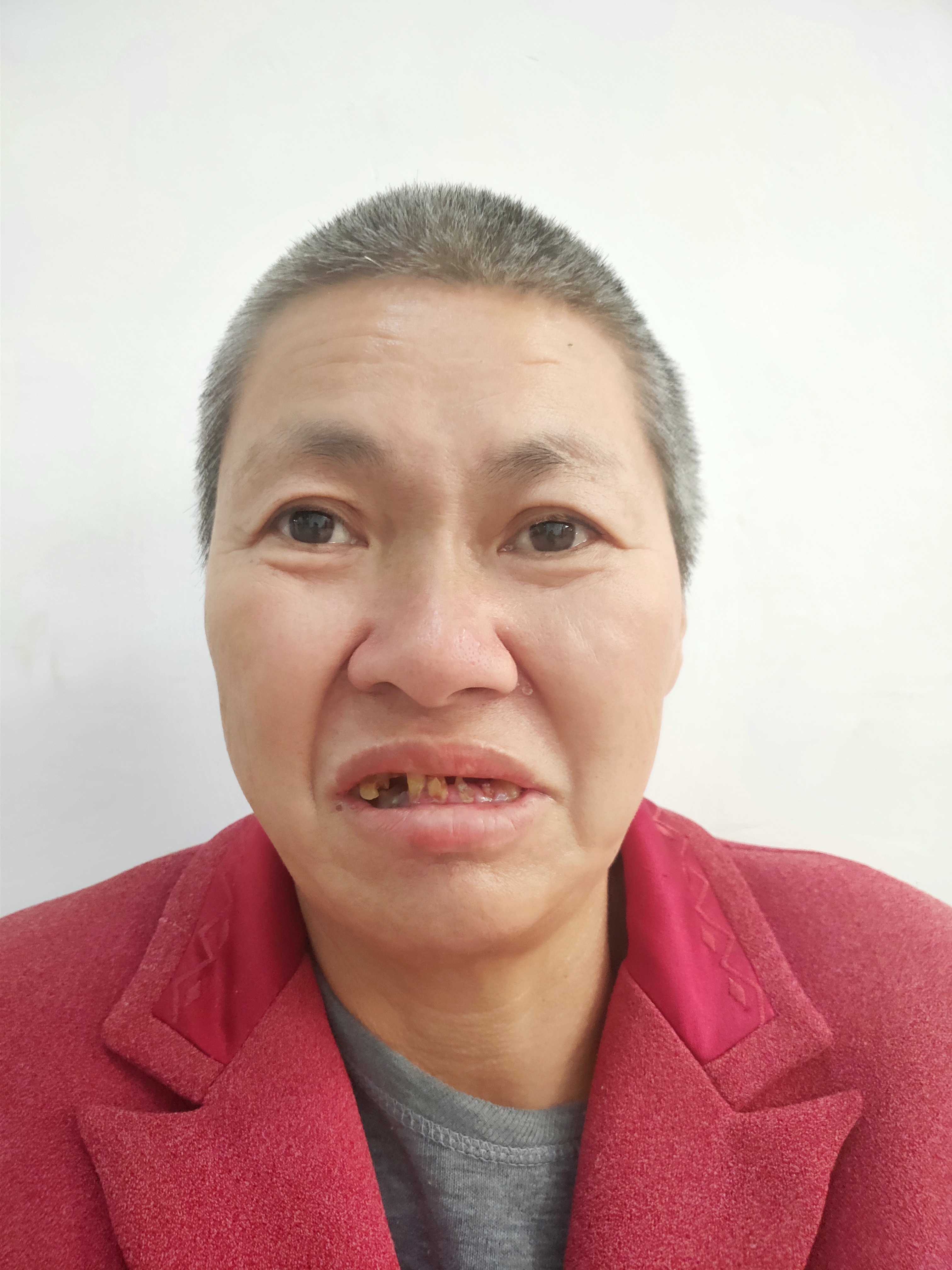 走失者照片 帮她回家：五旬女子在广东梅州被救助...