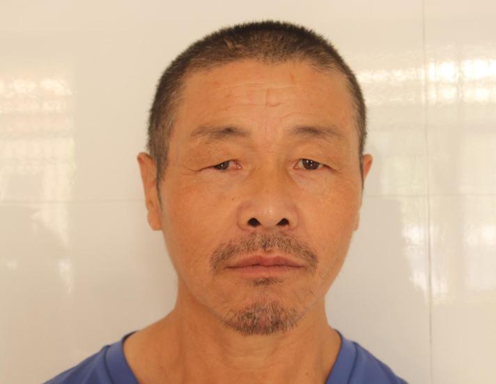 走失者照片 衢州寻亲：五旬男子被救助，头部有疤...