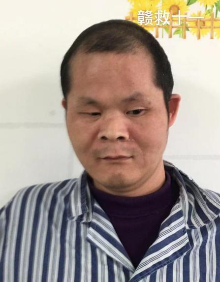 走失者照片 赣州寻亲：中年男子被救助数年，疑似...