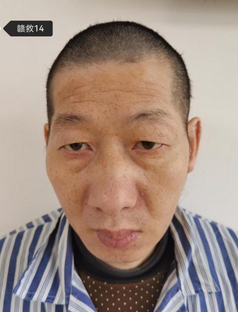 走失者照片 赣州寻亲：中年男子被救助数年，疑似...