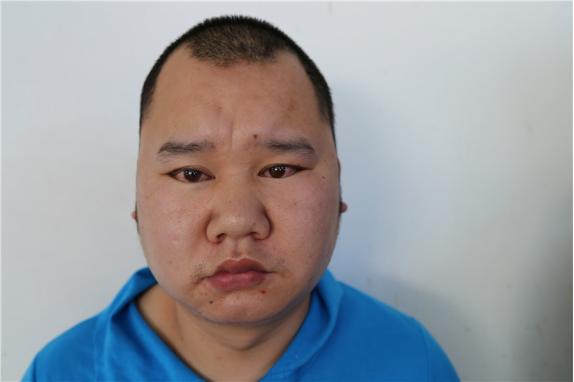 走失者照片 赣州寻亲：中年男子被救助多年，请帮...