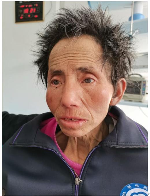 走失者照片 朔州寻亲：中年女子被救助，穿黑色外...