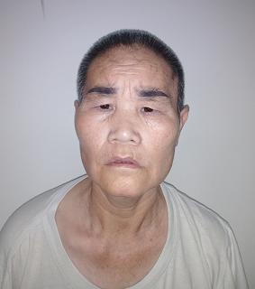 走失者照片 衡阳寻亲：五旬女子被长期救助，偏胖...