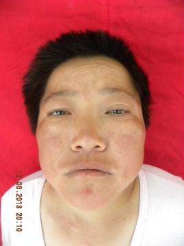 走失者照片 寻求:中年女子在天津被救助多年,自...
