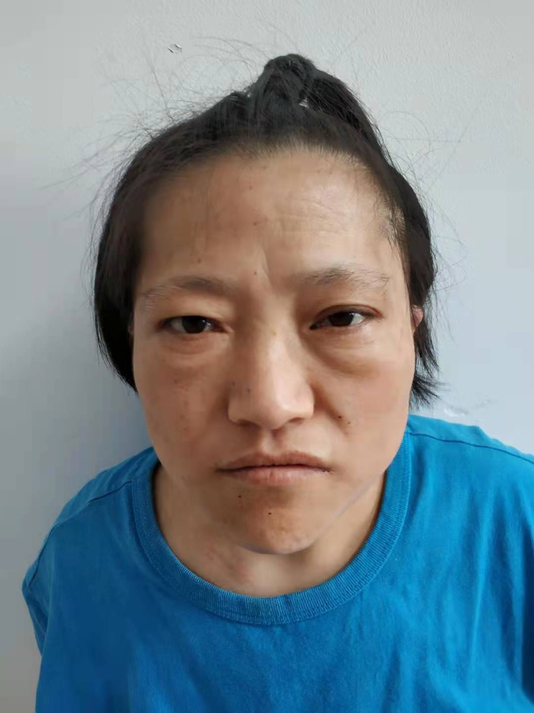 走失者照片 寻求：中年女子在天津被救助多年，自...