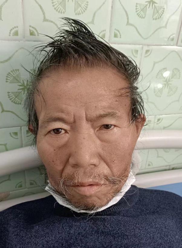 走失者照片 海口寻亲：六旬老人病重被送医，自述...