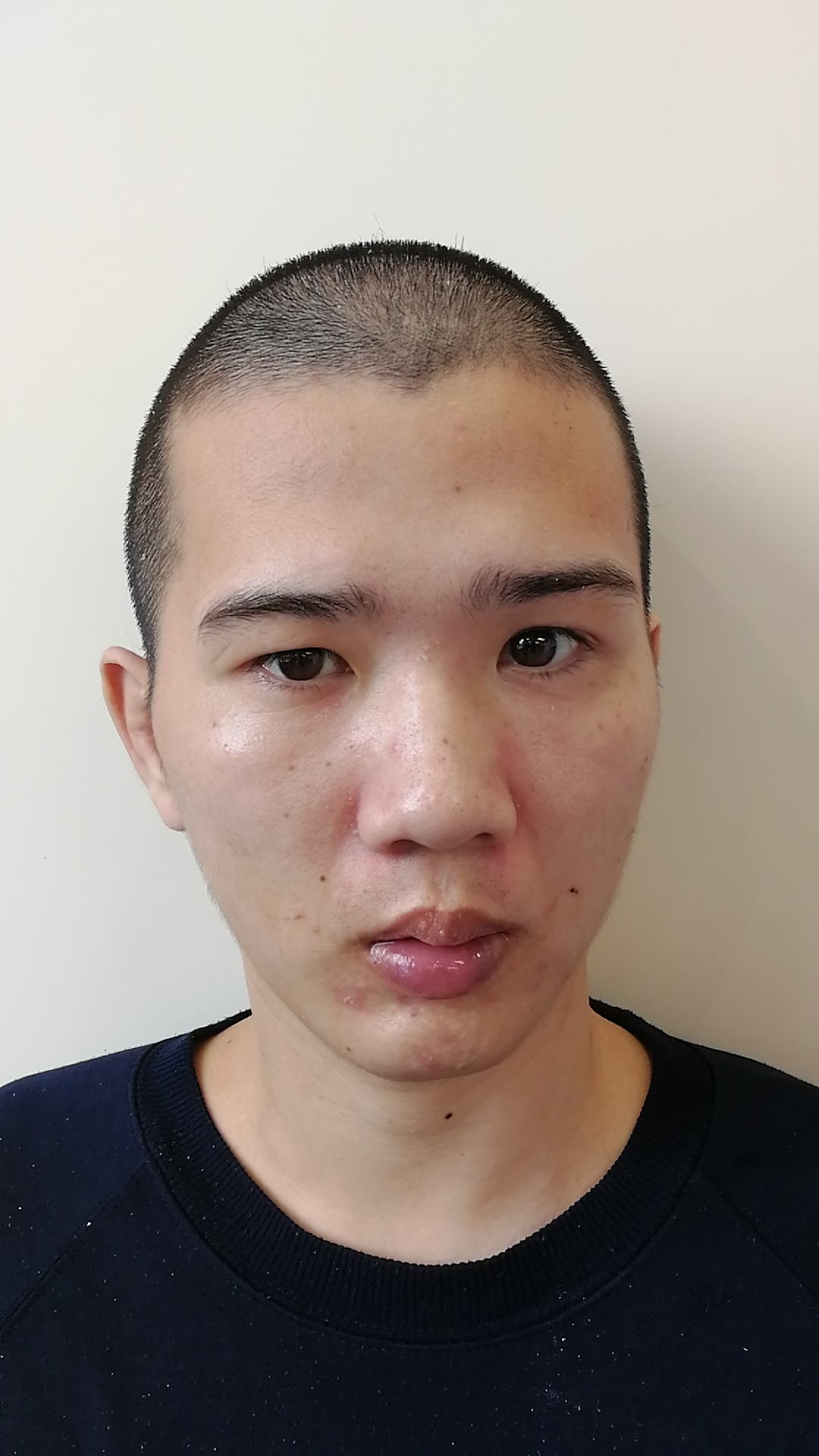 走失者照片 青年男子在深圳被救助多年，疑似广东...