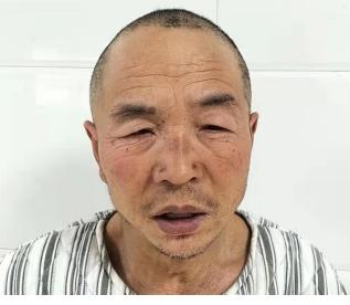走失者照片 周口寻亲：六旬老人被救助，穿黑色棉...