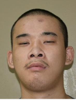 走失者照片 衡阳救助者：青年男子被长期救助，偏...