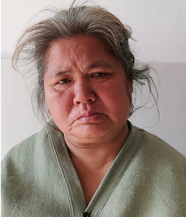走失者照片 湛江寻亲：五旬女子被救助，疑似精神...