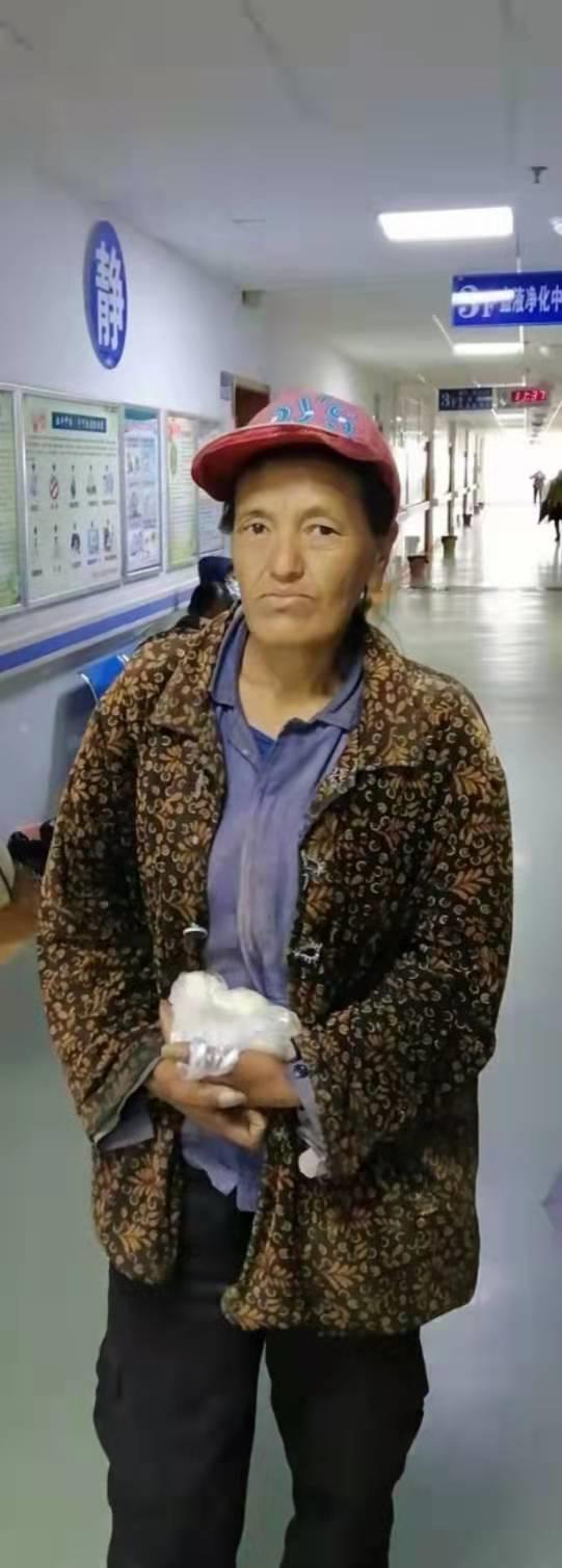 走失者照片 丽江寻亲：五旬女子被救助，上颌部分...