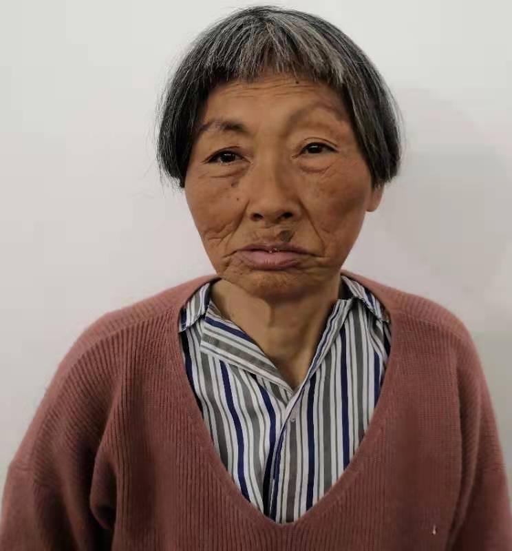 走失者照片 寻亲：漳州六旬老太被救助，花白头发...