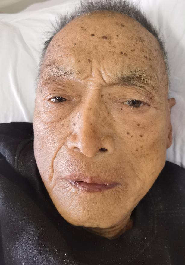 走失者照片 惠州寻亲:七旬老人被救助,穿黑色羽...